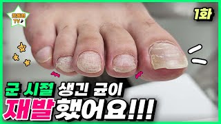 (eng sub)[1편]구독자분께서 방문해 주셨어요 ㅎㅎ｜레푸스 서면점/사상점｜ingrown toenail｜Athlete&#39;s foot-Fresh Foot