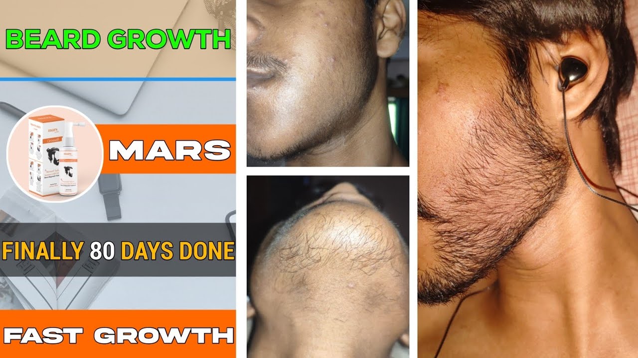 BEARD GROWTH Finally 80 Days Complete Fast Beard Growth From beard-growth-finally-80-days-complete-fast-beard-growth-from