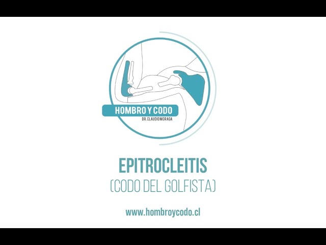 Codo: Epitrocleitis (codo del golfista)