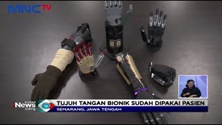 Inspiratif! Mahasiswa Undip Ciptakan Tangan Bionik Canggih bagi Penyandang Disabilitas - LIS 07/02