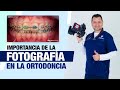 IMPORTANCIA DE LA FOTOGRAFÍA EN ORTODONCIA - ENTREVISTA VLM - Orthocenter  05  01  2021