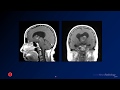 Neuroradiology board review 3 case 1