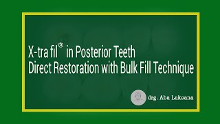 X-tra Fil® Bulk-Fill (86 % w/w) Composite Resin for Posterior Restorations | VOCO GmbH