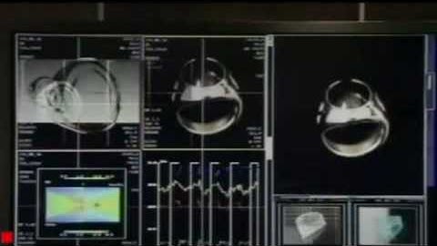 Flash Forward PROMO - 01x18/01x17 (REAL)  - Goodbye Yellow Brick Road - Legendada PT/BR