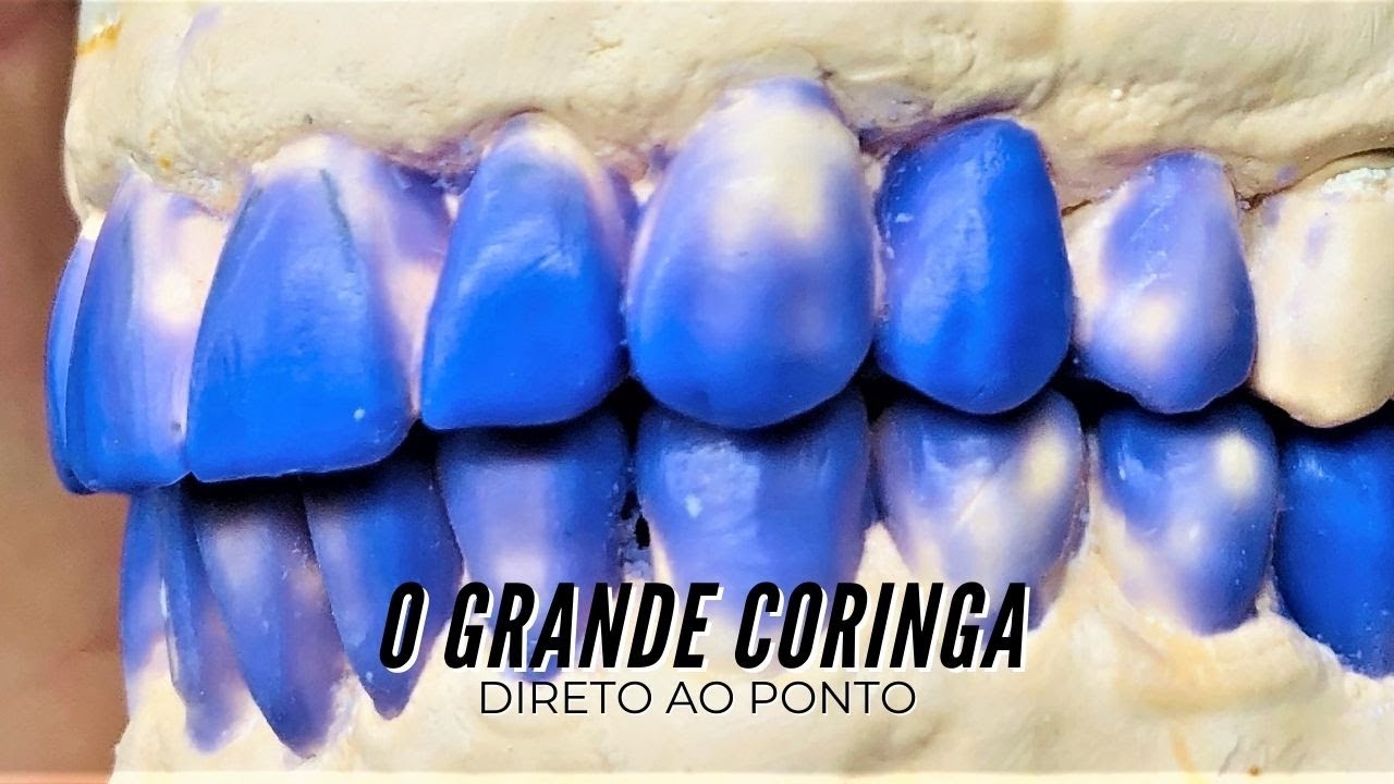 Enceramento Diagnostico - O grande coringa - Dica prática - YouTube