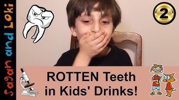Which drinks made the worst cavities? 😬 Dental Science 🔬Tooth Decay in a Microscope! (Ep.2)