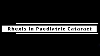 Rhexis Secrets for Paediatric Cataract Surgery! Precision in Tiny Eyes!