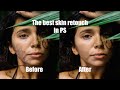 Skin repair step by step!