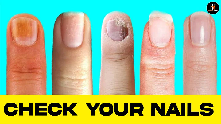 9 Things Your Nails Can Tell You About Your Health! (Shocking Signs You MUST NOT Ignore!)