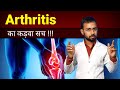 Arthritis treatment in Hindi | joint pain treatment | arthritis symptoms | how to cure arthritis