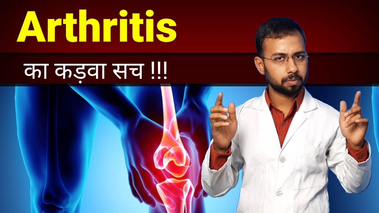 क्या Arthritis को जड़ से ख़त्म किया जा सकता है ? arthritis Treatment in