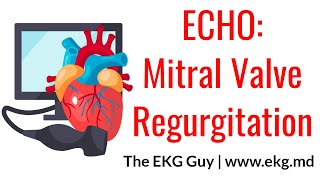 Mitral Valve Regurgitation - ECHO Course l The EKG Guy - www.ekg.md
