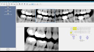 Eaglesoft Advanced Imaging Overview