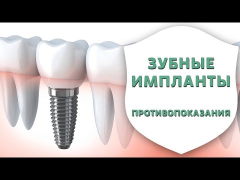 Кому запрещено ставить зубные импланты? | Противопоказания к имплантации зубов | Дентал ТВ