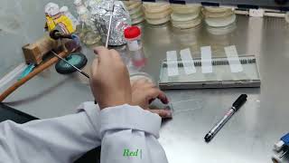 Slide preparation for bacteria identification