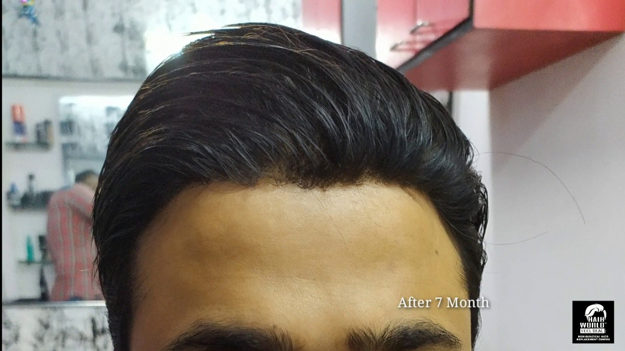 Hair Fixing For Men Hair Wigs For Men Hair Patch Hair System