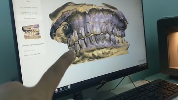 Hướng dẫn scan mẫu thach cao trên phần mền 3 Shape scan manager