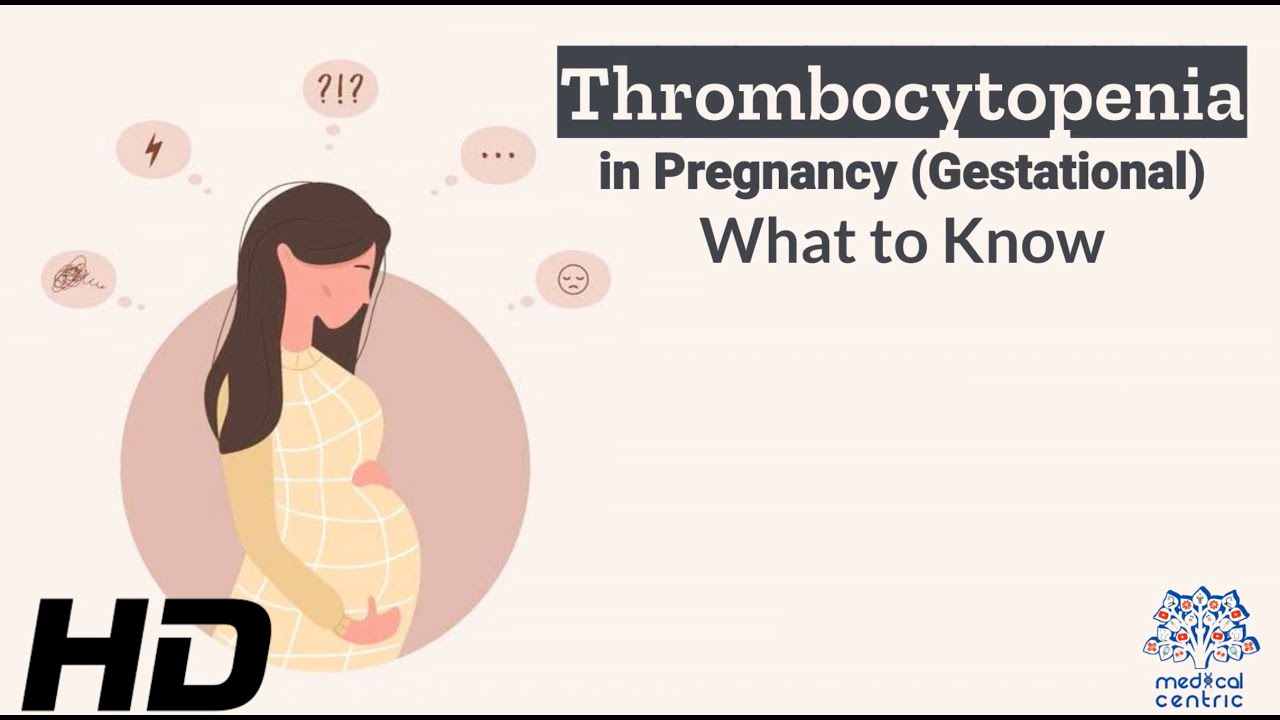 Thrombocytopenia in Pregnancy: Risks, Symptoms, and Treatmen