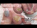 👣Diabetic Foot Care Tips and Pedicure Tutorial Part 1👣