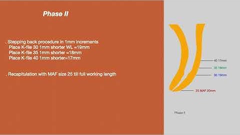 Step Back Technique in Endodontics