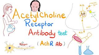 Acetylcholine Receptor Antibody Test | Labs 🧪