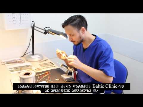 თვალის პროთეზირება Baltic Clinic-ში