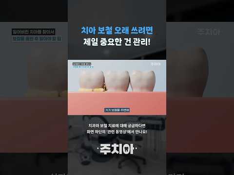 보철물을 오래 쓰는 방법 유튜브 영상 썸네일