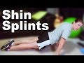 Shin splints stretches  exercises  ask doctor jo