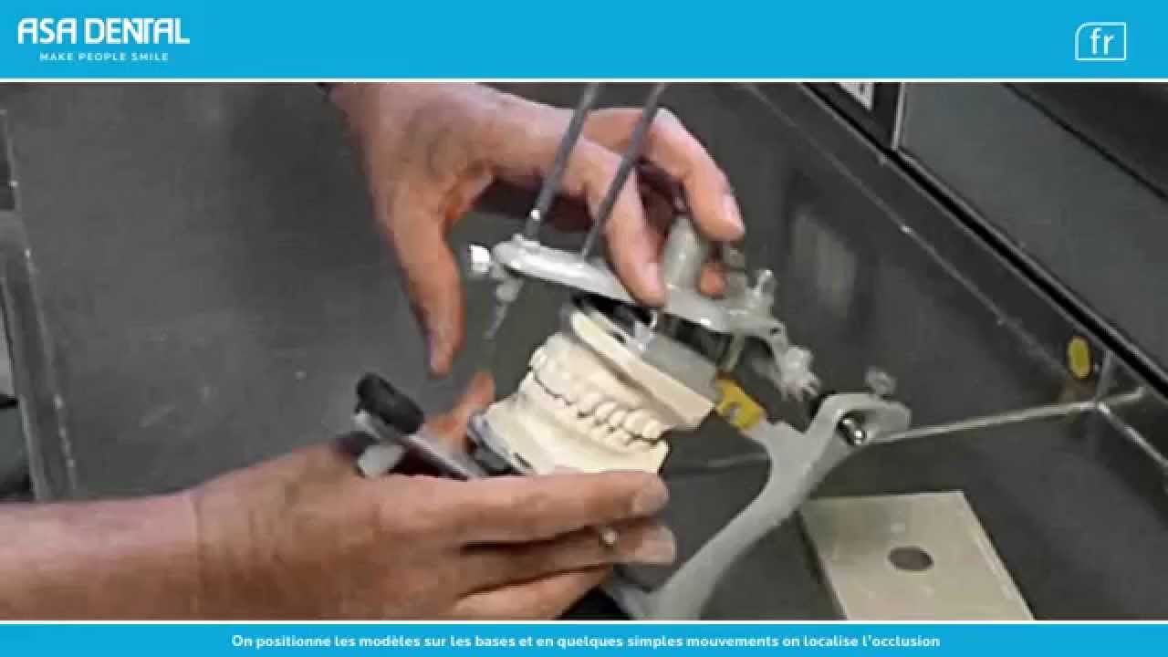 EasyKey - L'avantage du système sans plâtre (ASA DENTAL)