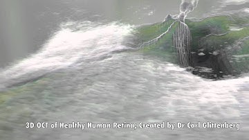 3D OCT of Healthy Retina