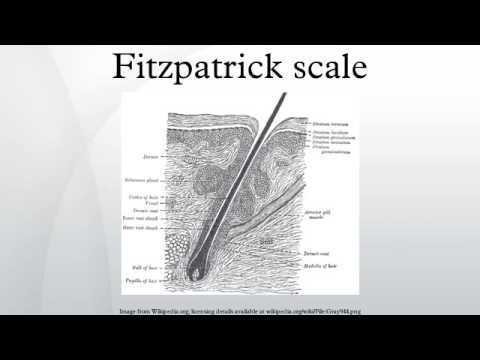 Fitzpatrick scale