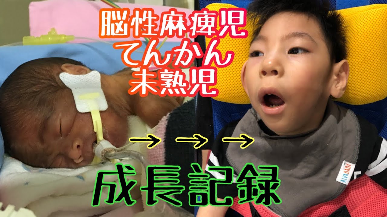 脳性麻痺児 難治性てんかん 未熟児】NICU退院から2歳5ヶ月まで【成長