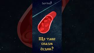 Що таке спазм судин?