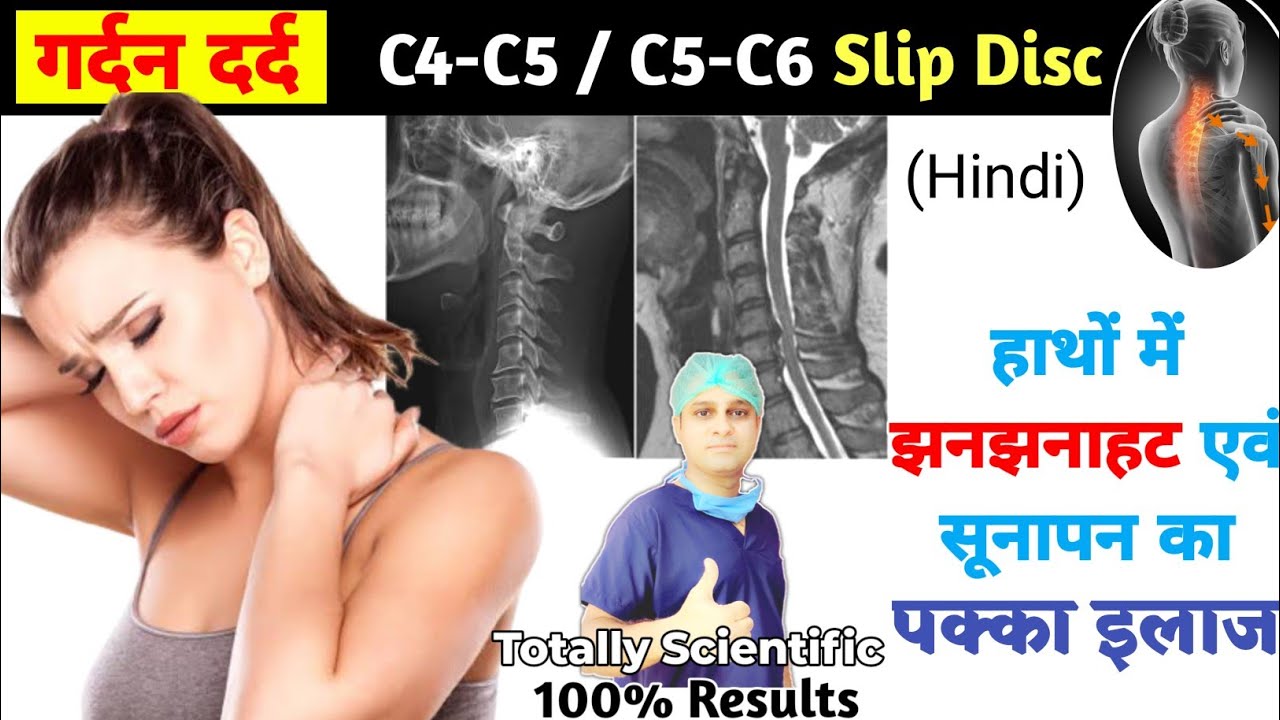 गर्दन की नस में दर्द का इलाज | C5-C6 Slipped Disc Ka Ilaz | गर्दन दर्द में कौनसी एक्सरसाइज करें