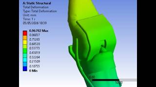 Biomech CAD Design & Fea Simulation of Knee Replacement TKR Prosthesis Implant in Solidworks & Ansys