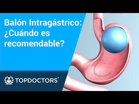 Balón Intragástrico: ¿Cuándo es recomendable?- Dr. Fabián Enrique Valle Carrión