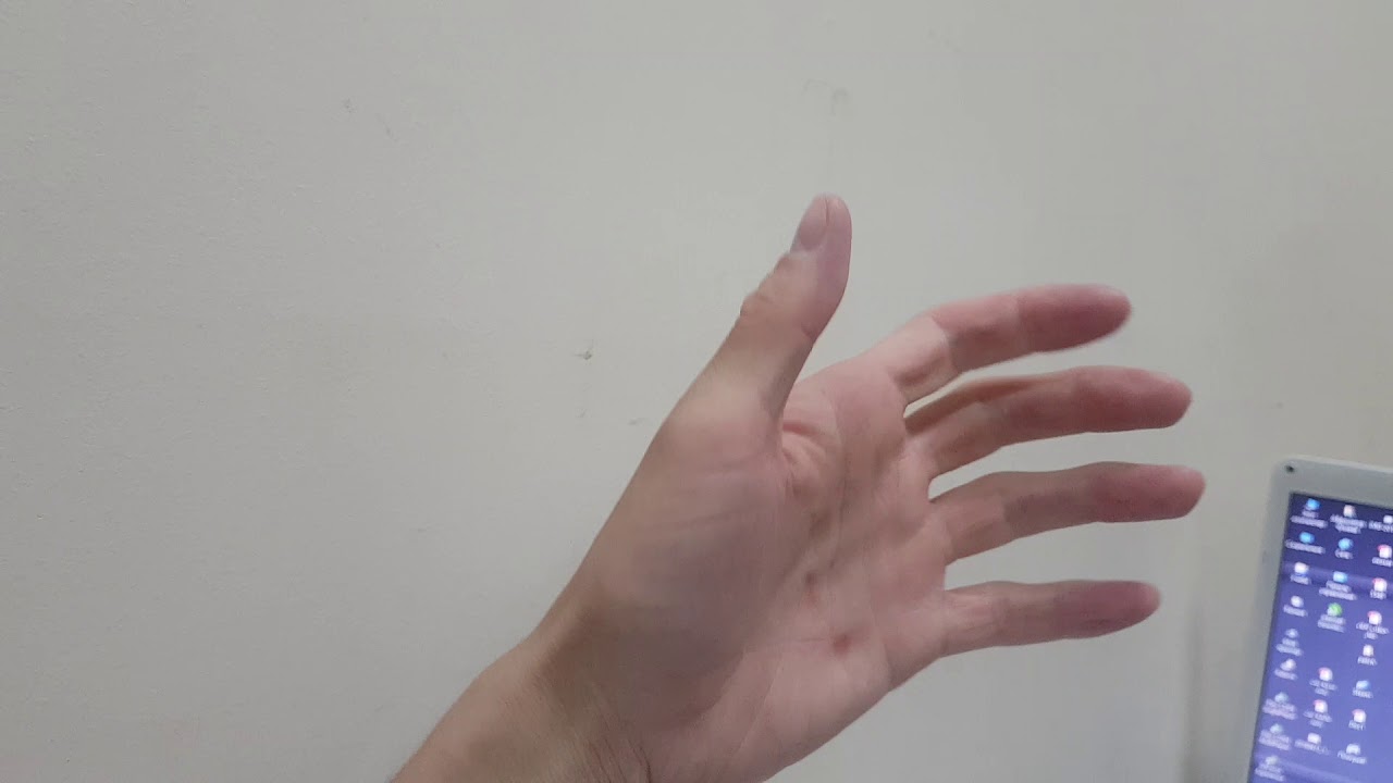 Хруст костяшками пальцев. Как научиться хрустеть пальцами. Стенозирующий лигаментит 1 пальца левой кисти. Причины хрустишь пальцами. Стенозирующий лигаментит.