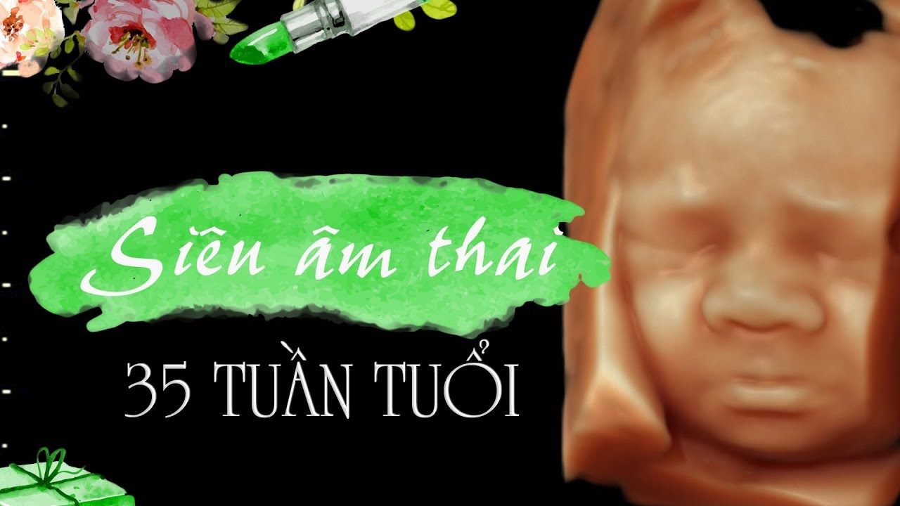 THAI NHI 35 TUẦN TUỔI - youtube