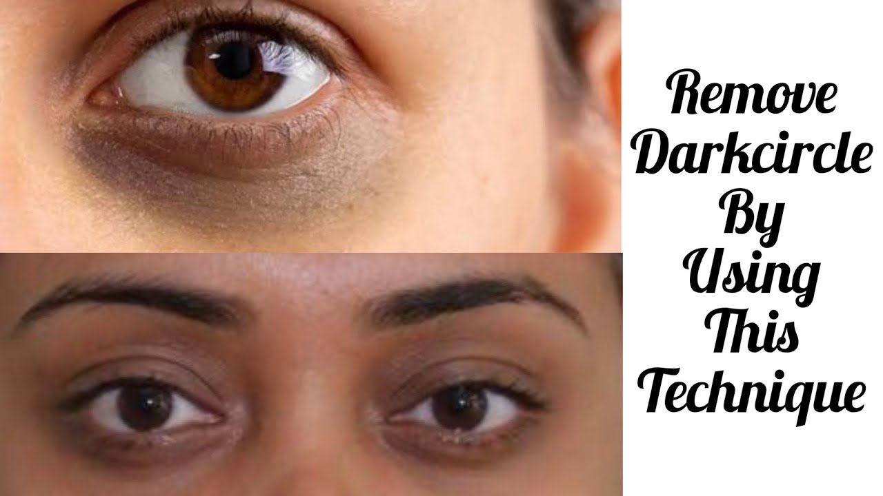 Remove Under Eye Dark Circles with GOSH Under Eye SERUM??? Review Demo