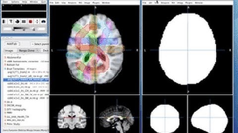 ROIs as Bit Planes, Selection