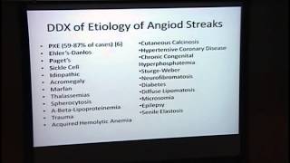 Subacute Vision Loss OU in a Middle Aged Woman [ARCHIVE]