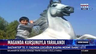 Maganda Kurşunuyla Yaralandı