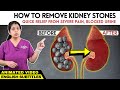 Animation  kidney stone pain relief        