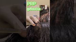 Prp Treatment In Sri Lanka Dr Nayani Madarasinghe