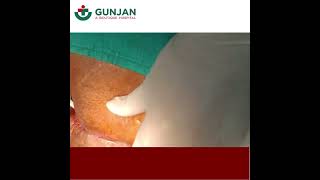 Pilonidal Sinus Treatment in Noida |  Get the Best Pilonidal Sinus Treatment  at Gunjan Hospital