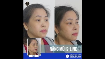 Vượt 200km đi nâng mũi S-Line và cái kết...