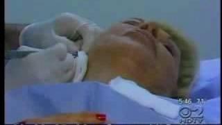 Torn Earlobe Repair; New York Plastic Surgery, Dr. Antell