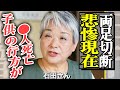 石田さんチの悲惨な現在に言葉を失う…家族離散、関係修復不可、両足切断に絶句…子供達の行方に驚きを隠せない!【芸能】