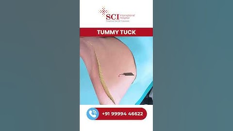 Tummy Tuck Surgery Explained 😱 | Flat Stomach Ka Secret? #tummytuck