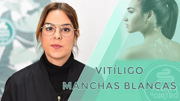 ¿Cómo pigmentar manchas blancas en la piel?